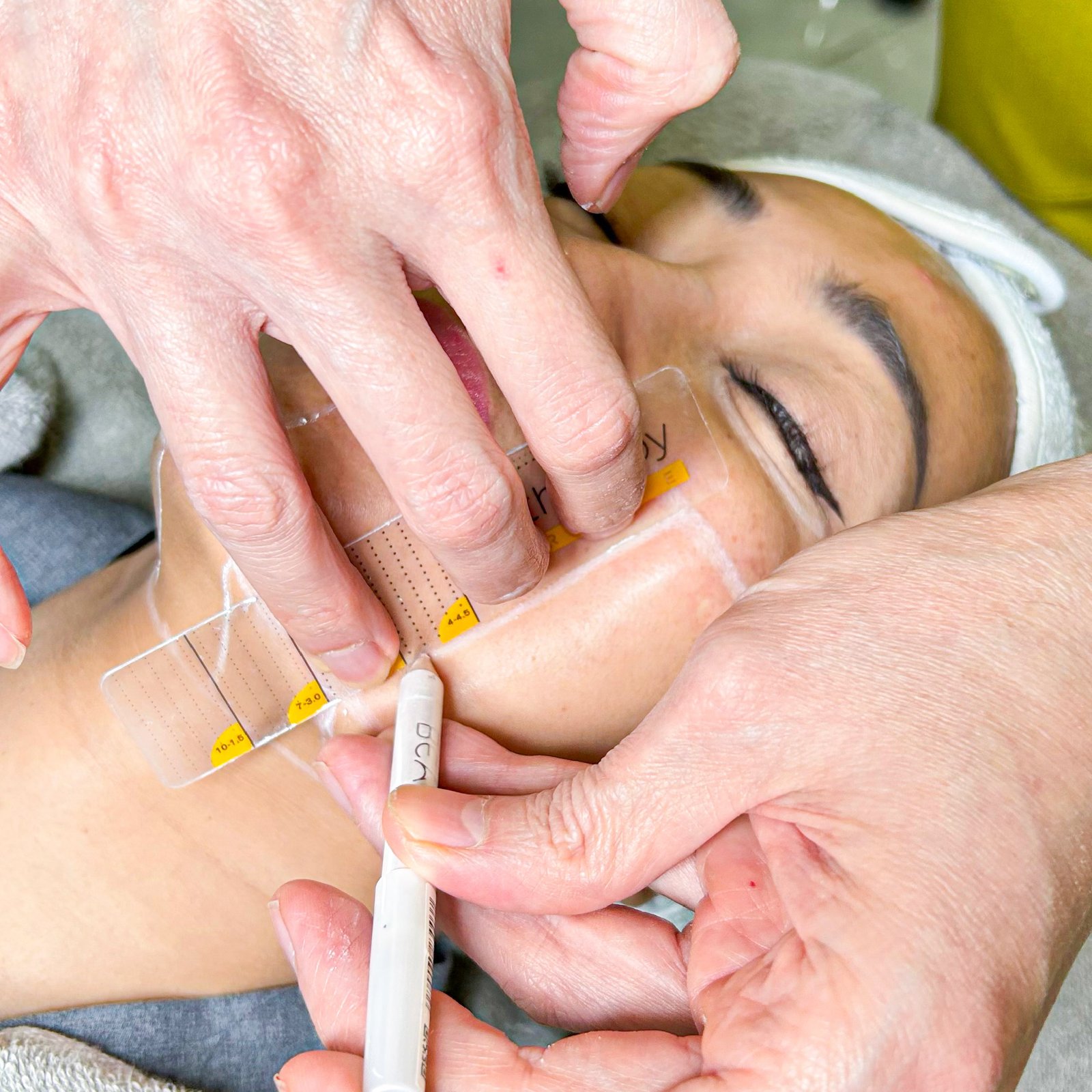 aset fikri ultherapy-11.jpg