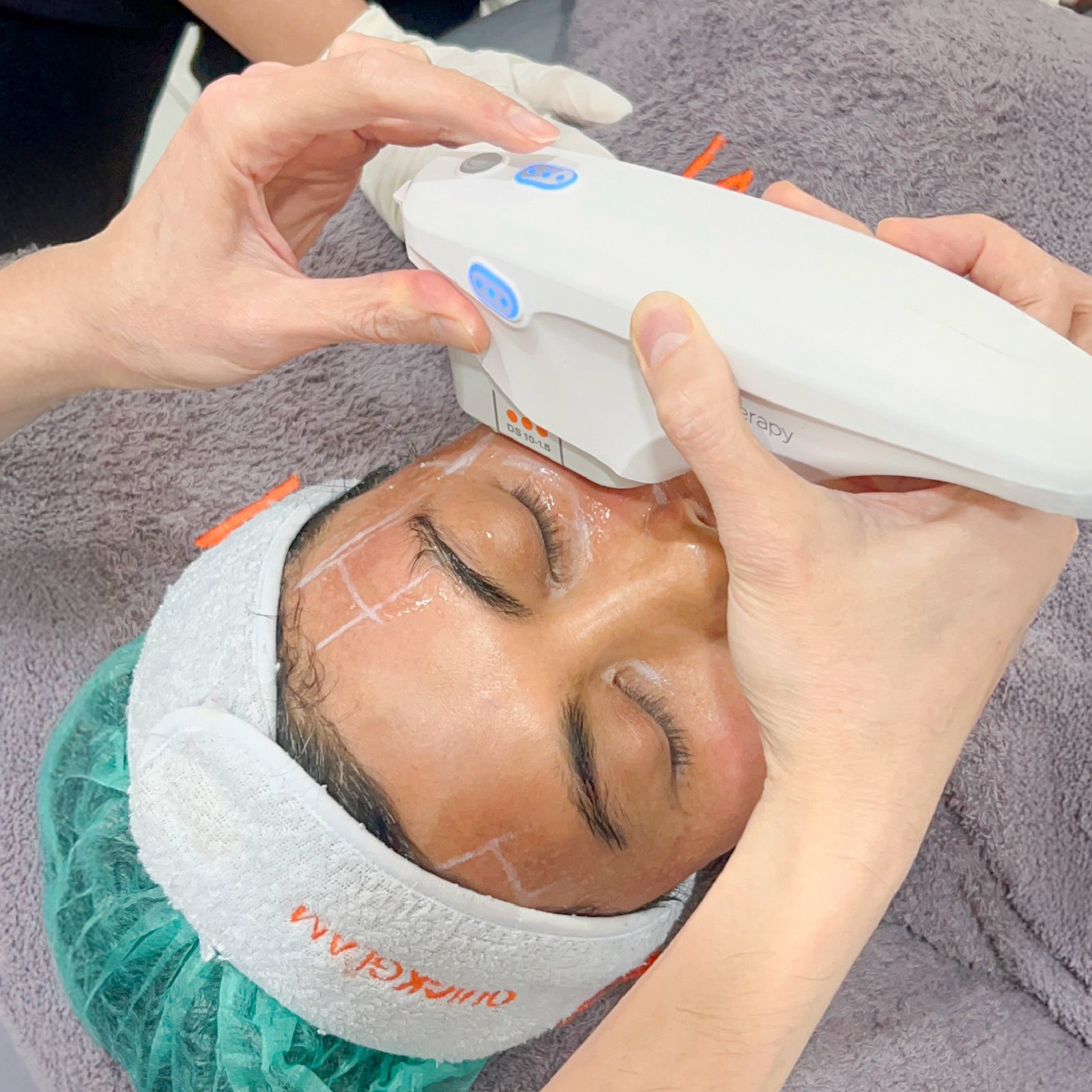 aset fikri ultherapy-16.jpg
